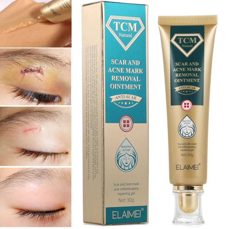 Fast Effective Acne Scar Removal Cream Pimple Stretch Marks Face Gel Remove Acne Smoothing Whitening Moisturizing Body Skin Care
Fast Effective Acne Scar Removal Cream Pimple Stretch Marks Face Gel Remove Acne Smoothing Whitening Moisturizing Body Skin Care