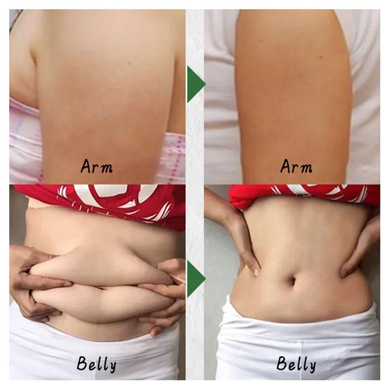 Plants Cellulite Slimming Cream Belly Fat Soothes Leg Relaxed Adipose Massage Slim Fast Tightens Skin Fat Burn Slim Cream 40g
Plants Cellulite Slimming Cream Belly Fat Soothes Leg Relaxed Adipose Massage Slim Fast Tightens Skin Fat Burn Slim Cream 40g