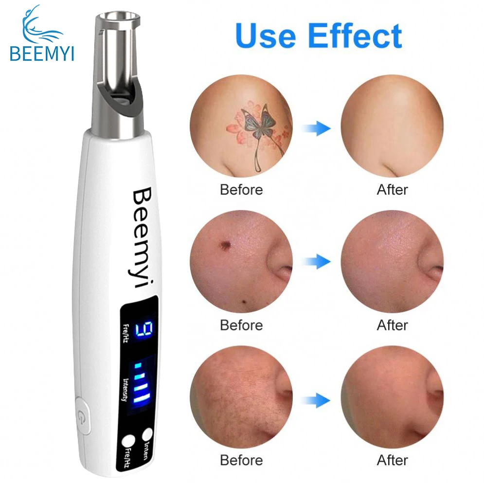 

Beemyi Laser Picosecond Pen Red Blue Light Therapy Tattoo Remove Freckle Acne Mole Dark Spot Pigment Removal Machine Skin Care