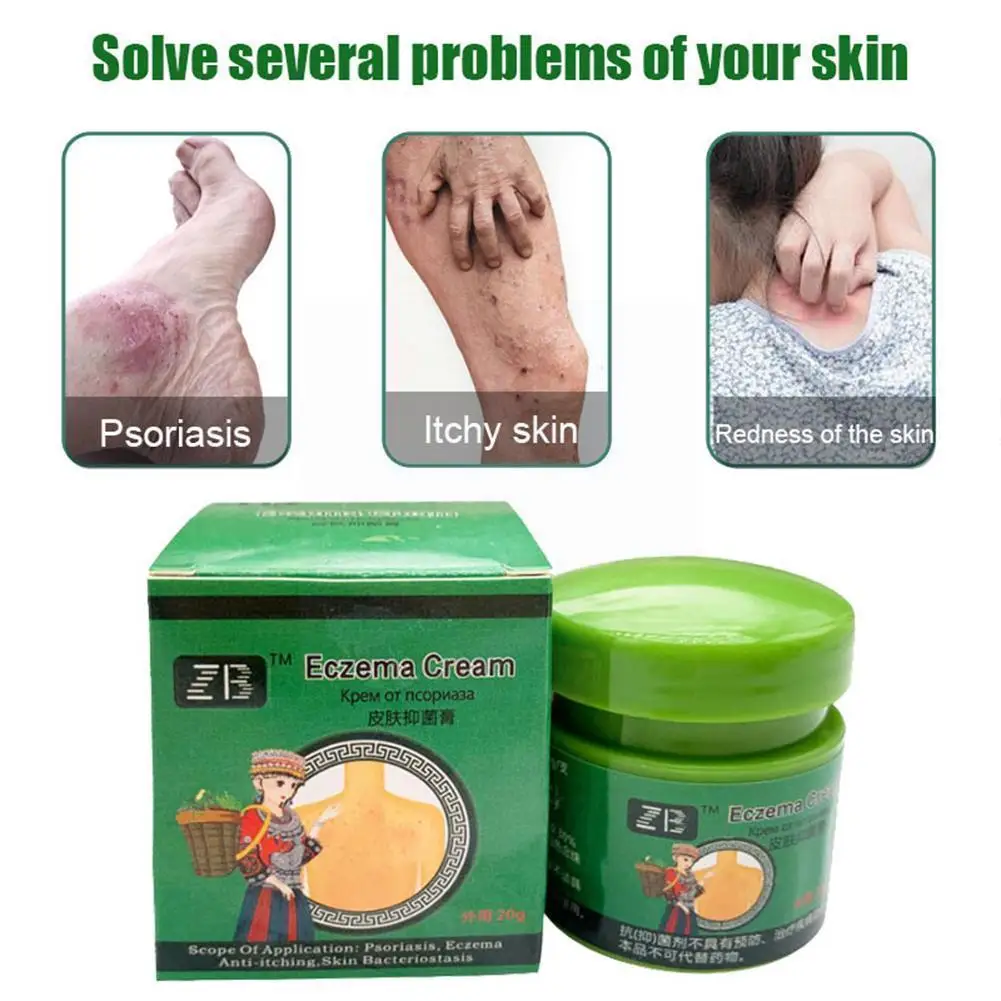 Effectively Antibacterial Skin Psoriasis Cream Dermatitis Desquamation Eczema Ointment Psoriasis Eczematoid Urticaria Skin V1j1
Effectively Antibacterial Skin Psoriasis Cream Dermatitis Desquamation Eczema Ointment Psoriasis Eczematoid Urticaria Skin V1j1