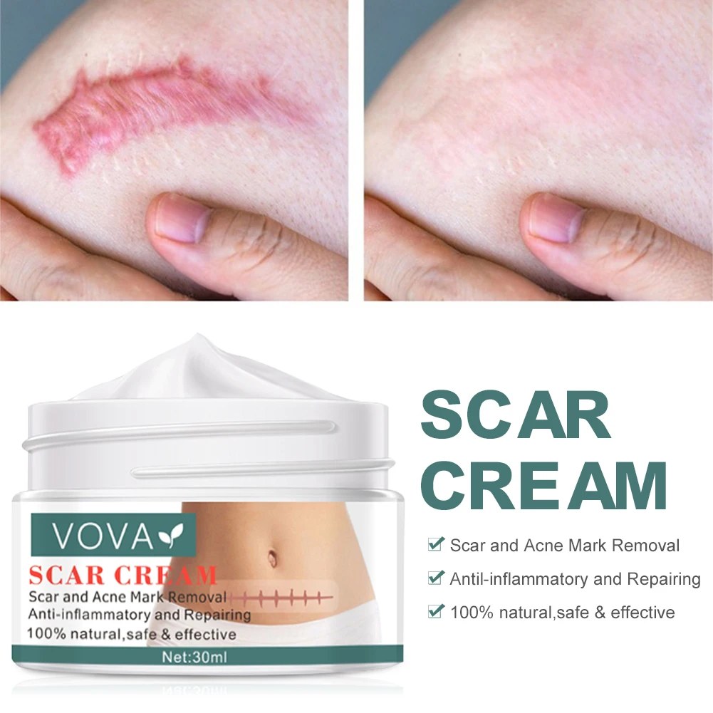 VOVA Whitening Removal Scar Acne Cream Stretch Marks Face Pimples Gel Remove Acne Smoothing Moisturizing Body Beauty Skin Care
VOVA Whitening Removal Scar Acne Cream Stretch Marks Face Pimples Gel Remove Acne Smoothing Moisturizing Body Beauty Skin Care