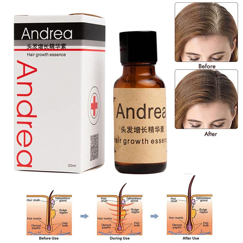 Hair Growth Ginger Essence Oil Anti Hair Loss Natural Plant Essence Products Repair Damaged Hair Beauty Hair Care Tools 20ML
Hair Growth Ginger Essence Oil Anti Hair Loss Natural Plant Essence Products Repair Damaged Hair Beauty Hair Care Tools 20ML