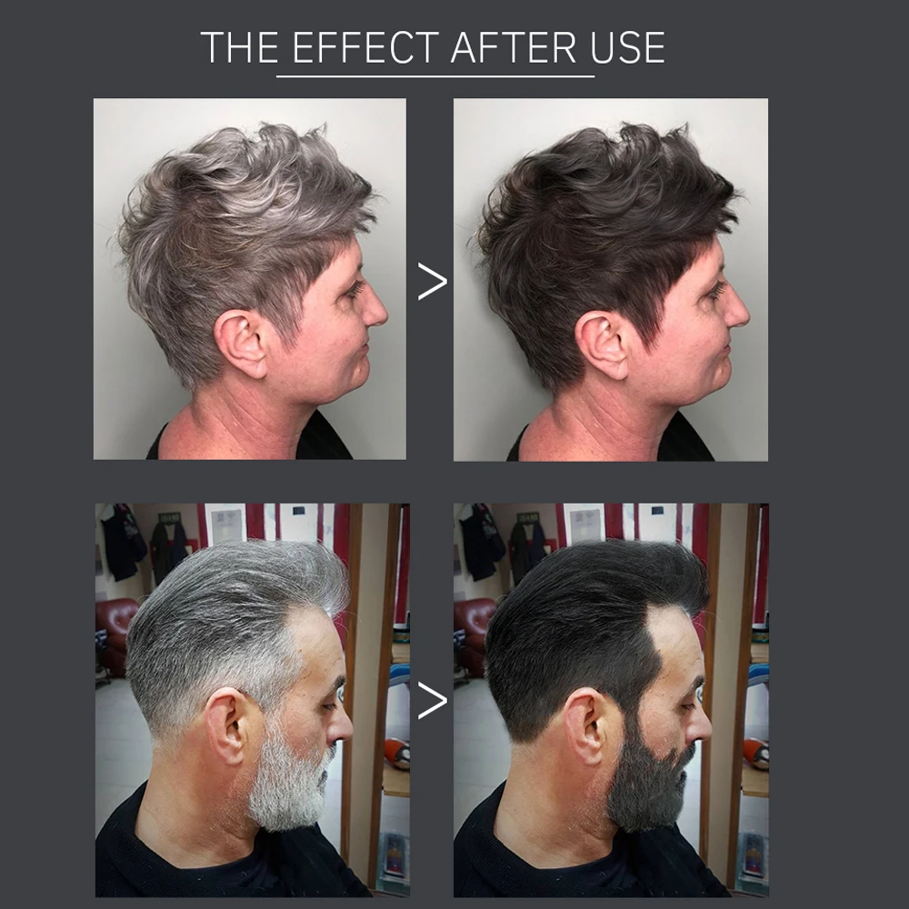 250ml Hair Dye Shampoo Fast Black Hair Organic Natural Plant Essence Permanent Color For Women Men Cover Gray White Hair
250ml Hair Dye Shampoo Fast Black Hair Organic Natural Plant Essence Permanent Color For Women Men Cover Gray White Hair