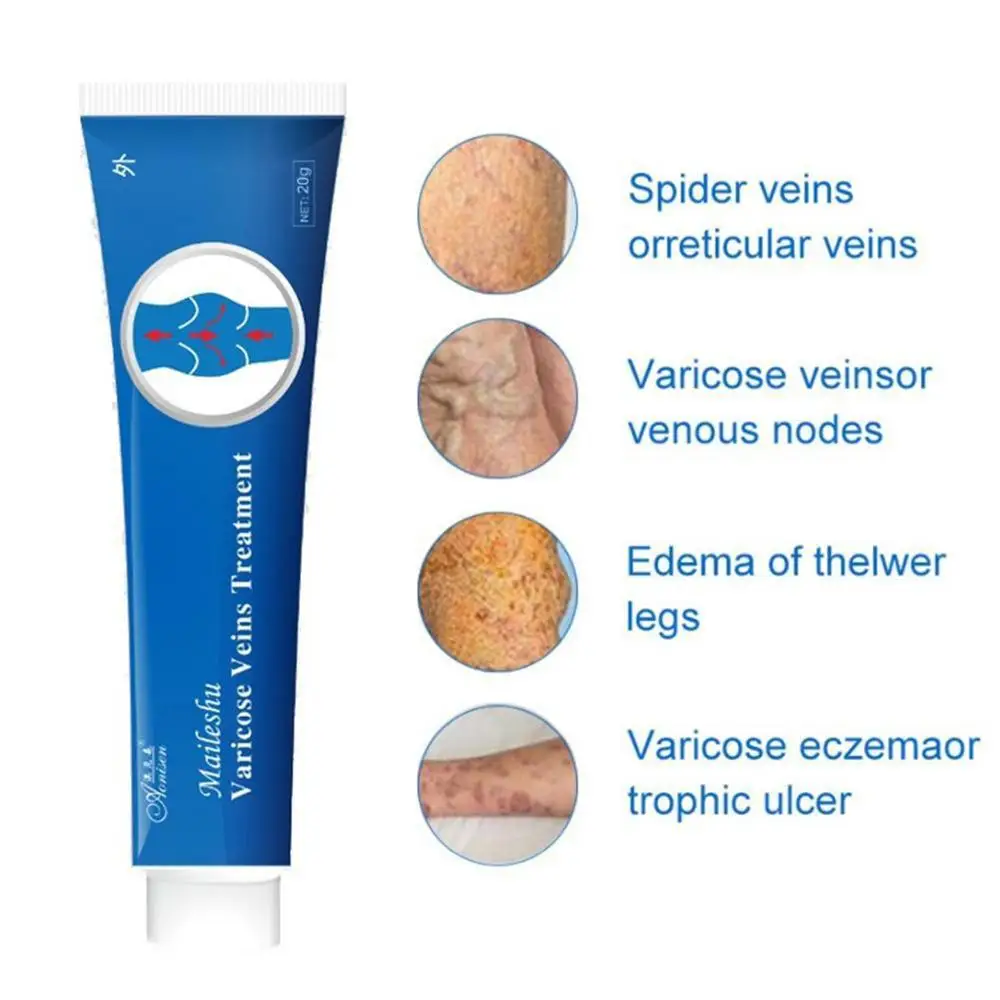 20ml Varicose Veins Treatment Cold Therapy Cream Gel Effective Improve Vasculitis Phlebitis Pain Relief Angiite Rotten Legs
20ml Varicose Veins Treatment Cold Therapy Cream Gel Effective Improve Vasculitis Phlebitis Pain Relief Angiite Rotten Legs