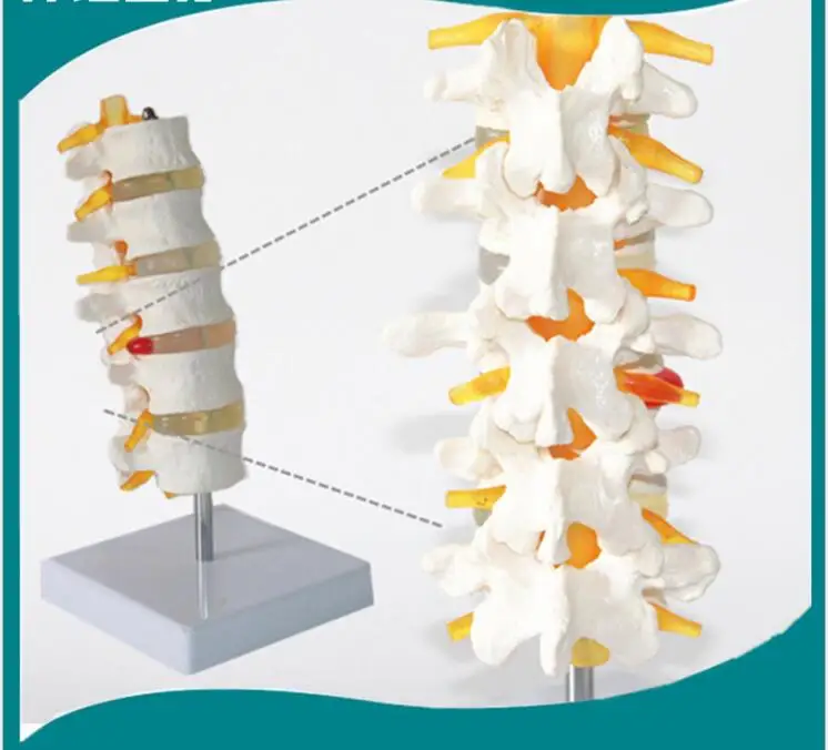 1:1 5 Section lumbar model Spinal nerve model caudal equina nerve lumbar spine disc model Spine Chiropractic skeleton models
1:1 5 Section lumbar model Spinal nerve model caudal equina nerve lumbar spine disc model Spine Chiropractic skeleton models