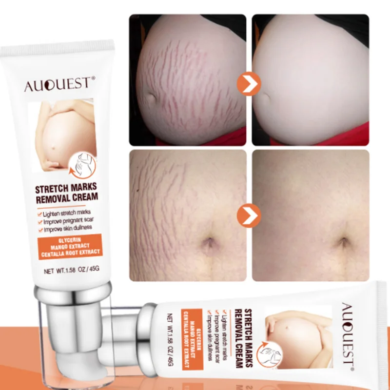 Maternity Stretch Marks Removal Cream Body Buttock Breast Mark Skin Care Effective Anti White Stretch Scar Remover Cream 45g
Maternity Stretch Marks Removal Cream Body Buttock Breast Mark Skin Care Effective Anti White Stretch Scar Remover Cream 45g