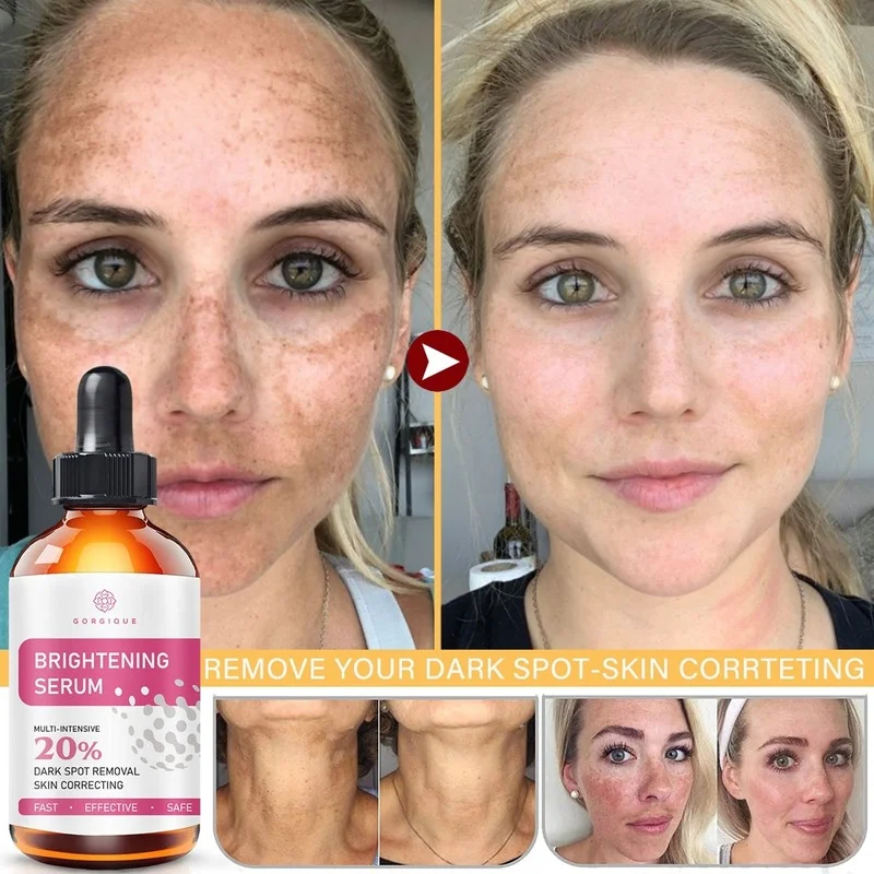 10/30Whitening Face Serum Remove Dark Circles Fade Freckles Spots Melanin Facial Serum Skin Care
10/30Whitening Face Serum Remove Dark Circles Fade Freckles Spots Melanin Facial Serum Skin Care