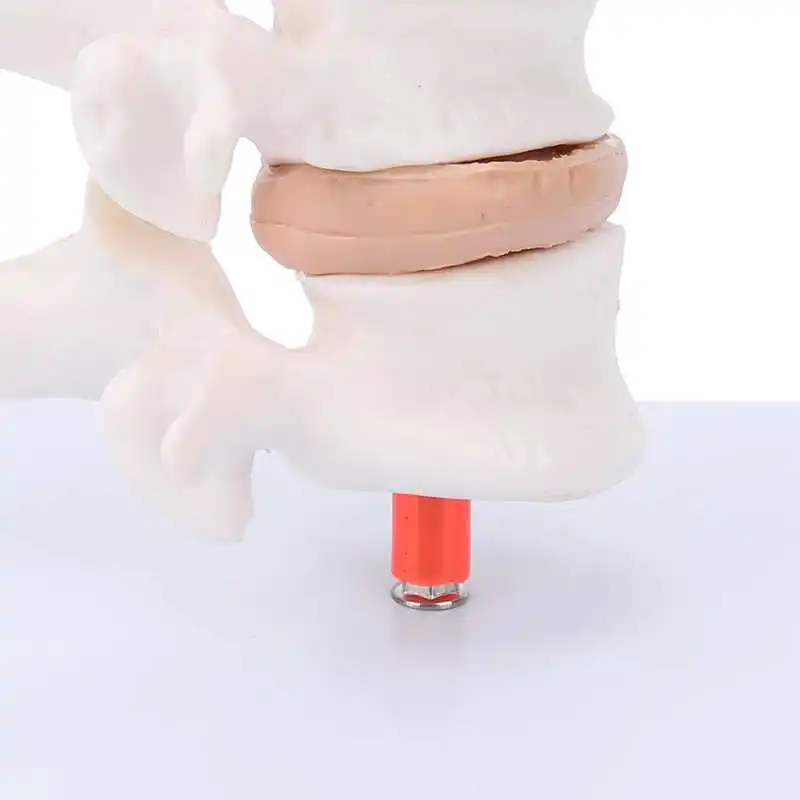 Anatomical Osteoporosis Model Safe Osteoporosis Model Ecofriendly for Model Display for Teaching for Doctorpatient
Anatomical Osteoporosis Model Safe Osteoporosis Model Ecofriendly for Model Display for Teaching for Doctorpatient