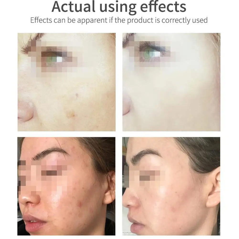 VC Facial Cleanser Natural Nourishing Repair Facial Cleanser Skin Care Whitening Moisturizing Face Washing Products
VC Facial Cleanser Natural Nourishing Repair Facial Cleanser Skin Care Whitening Moisturizing Face Washing Products