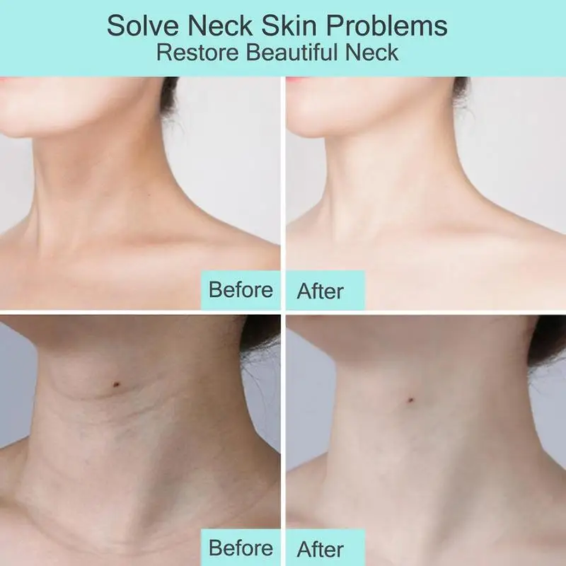 Vitamin C Firming Lifting Neck Cream Anti-ageing Hydrates Improve Elasticity Neck Care Remove Cream With Wheel Head
Vitamin C Firming Lifting Neck Cream Anti-ageing Hydrates Improve Elasticity Neck Care Remove Cream With Wheel Head