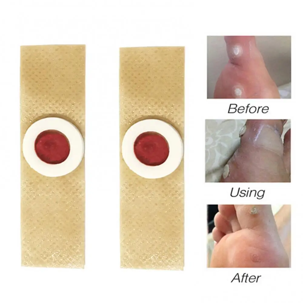 80% Hot Sale 42Pcs Painless Medical Corns Patch Callus Removal Soften Horny Skin Foot Care
80% Hot Sale 42Pcs Painless Medical Corns Patch Callus Removal Soften Horny Skin Foot Care