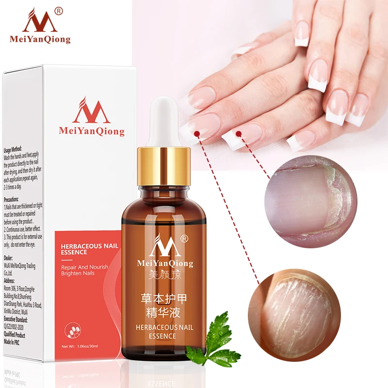 Nail Fungal Treatment Feet Care Essence Nail Foot Whitening Toe Nail Fungus Removal Gel Anti Infection Paronychia Onychomycosis
Nail Fungal Treatment Feet Care Essence Nail Foot Whitening Toe Nail Fungus Removal Gel Anti Infection Paronychia Onychomycosis