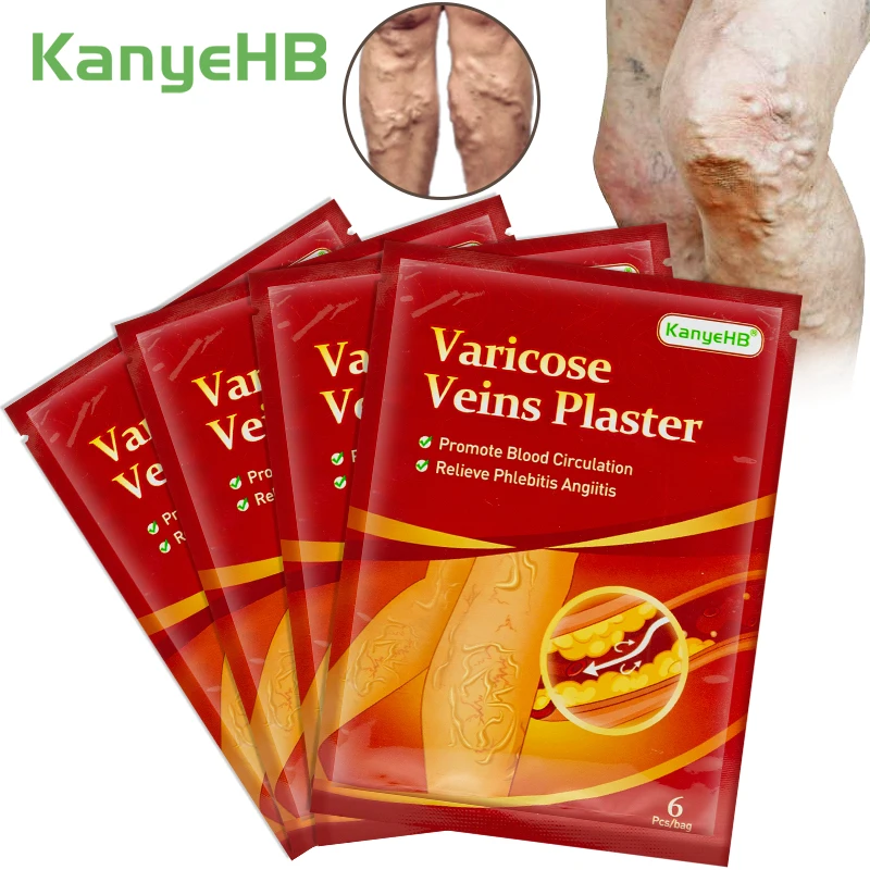 24pcs Varicose Veins Treatment Plaster Varicosity Angiitis Ointment Relief Veins Pain Phlebitis Legs Varicose Veins Patch A595
24pcs Varicose Veins Treatment Plaster Varicosity Angiitis Ointment Relief Veins Pain Phlebitis Legs Varicose Veins Patch A595