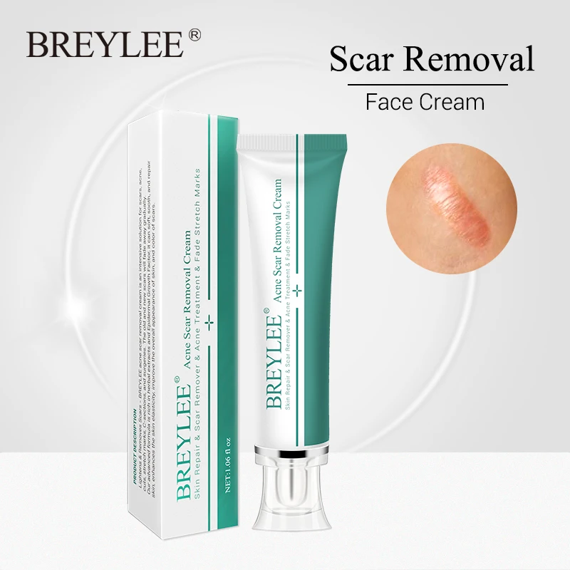 BREYLEE Acne Scar Removal Cream 30g Face Cream Skin Repair Skin Care Scar Acne Treatment Remove Stretch Marks Whitening Cream 
BREYLEE Acne Scar Removal Cream 30g Face Cream Skin Repair Skin Care Scar Acne Treatment Remove Stretch Marks Whitening Cream