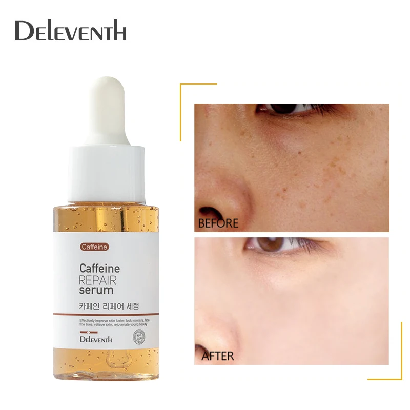 Caffeine Fades Spots Repair Serum Remove Freckle Improve Dull Yellowish Face Essence Whitening Brighten Anti-Oxidation Skin Care
Caffeine Fades Spots Repair Serum Remove Freckle Improve Dull Yellowish Face Essence Whitening Brighten Anti-Oxidation Skin Care