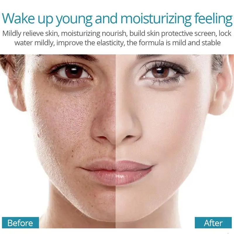 Effective Whitening Freckle Cream Melasma Acne Spot Pigment Pigmentation Moisturizing Gel Skin Rejuvenation Moisturizing Cream
Effective Whitening Freckle Cream Melasma Acne Spot Pigment Pigmentation Moisturizing Gel Skin Rejuvenation Moisturizing Cream