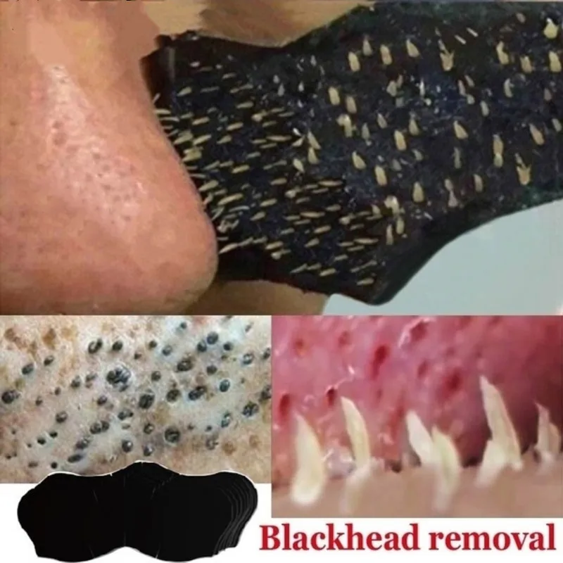 1PC Bamboo Charcoal Blackhead Remover Nose Mask Deep Clean Nose Cleansing Strips Black Head Remover Tool
1PC Bamboo Charcoal Blackhead Remover Nose Mask Deep Clean Nose Cleansing Strips Black Head Remover Tool