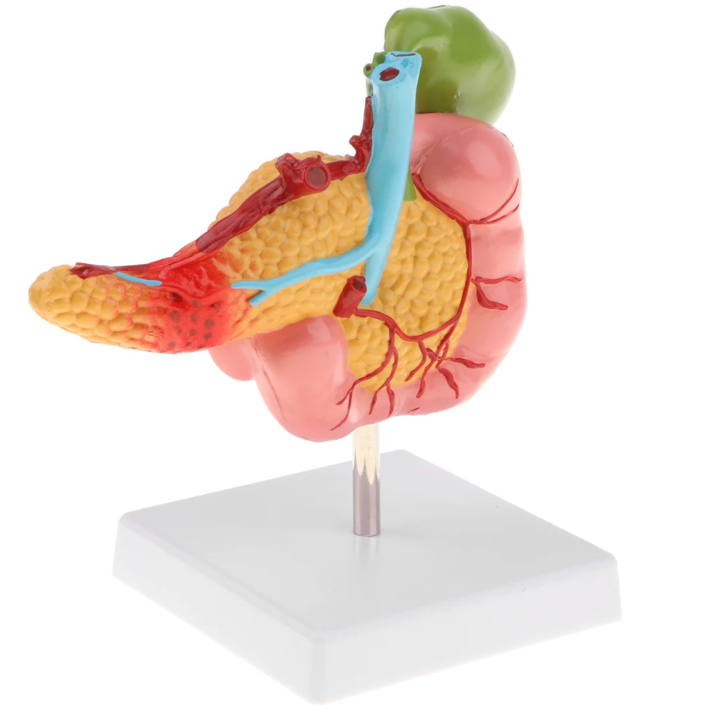 Lifesize человеческая желчная пузырь Duodenum патологическая модель с кровью |