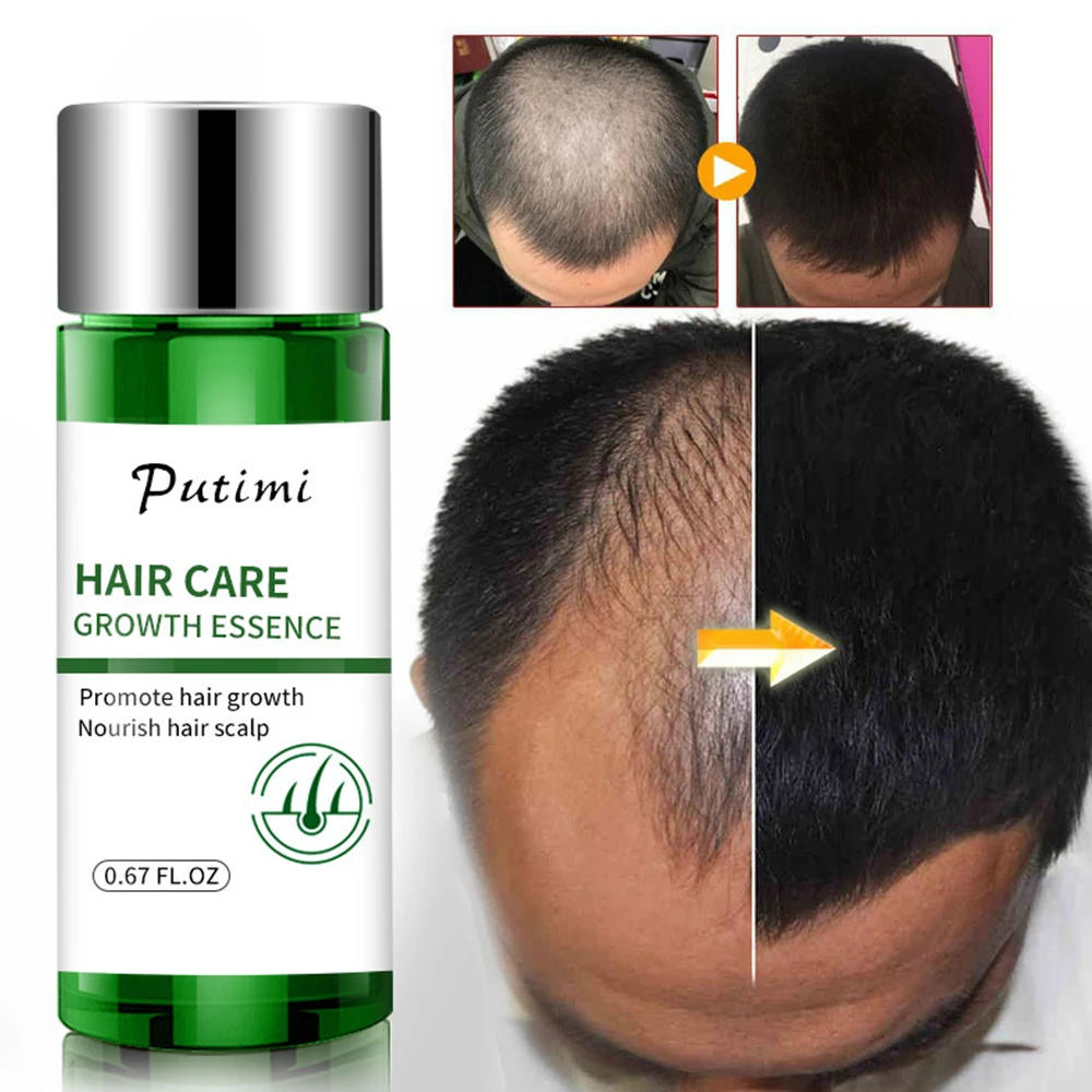 Ginger Hair Growth Essential Oils Prevent Hair Loss Fast Growth Natural Hair Growth Serum Repair Damaged Hair Care Men Women
Ginger Hair Growth Essential Oils Prevent Hair Loss Fast Growth Natural Hair Growth Serum Repair Damaged Hair Care Men Women
