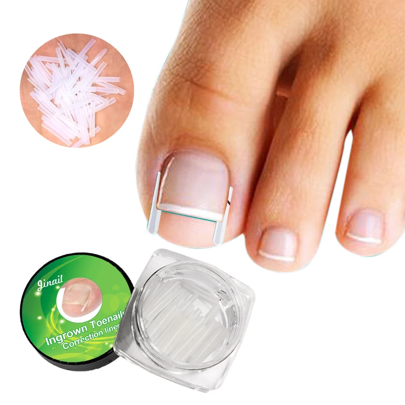 10pcs/set Ingrown Nail Pad Ortho Nail Filling Nail Groove Pad Ingrown Nail Corrector Ingrown Nail Artifact foot care
10pcs/set Ingrown Nail Pad Ortho Nail Filling Nail Groove Pad Ingrown Nail Corrector Ingrown Nail Artifact foot care