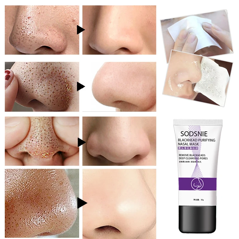 Blackhead Remover Nose Face Mask Pore Strip tearing Black Mask Peeling Acne Treatment Unisex Deep Cleansing Skin Care Korea
Blackhead Remover Nose Face Mask Pore Strip tearing Black Mask Peeling Acne Treatment Unisex Deep Cleansing Skin Care Korea