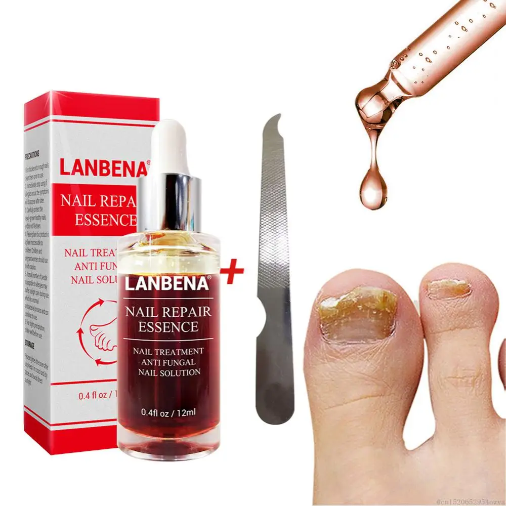 Cream from Nail Fungus Labena Toenail Repair for Fungi Lanbena Against Onychomycosis Leg Remedy Lambena Antifungal Foot Mushroom
Cream from Nail Fungus Labena Toenail Repair for Fungi Lanbena Against Onychomycosis Leg Remedy Lambena Antifungal Foot Mushroom