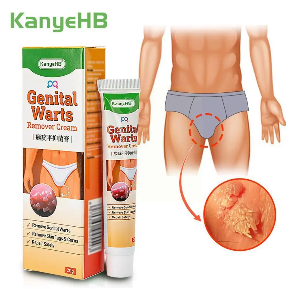 20g Wart Remover Ointment Genital Herpes Genital Vulva Antibacterial Acuminatum Condyloma Skin Treatment Tag Cream Remover A7F8
20g Wart Remover Ointment Genital Herpes Genital Vulva Antibacterial Acuminatum Condyloma Skin Treatment Tag Cream Remover A7F8