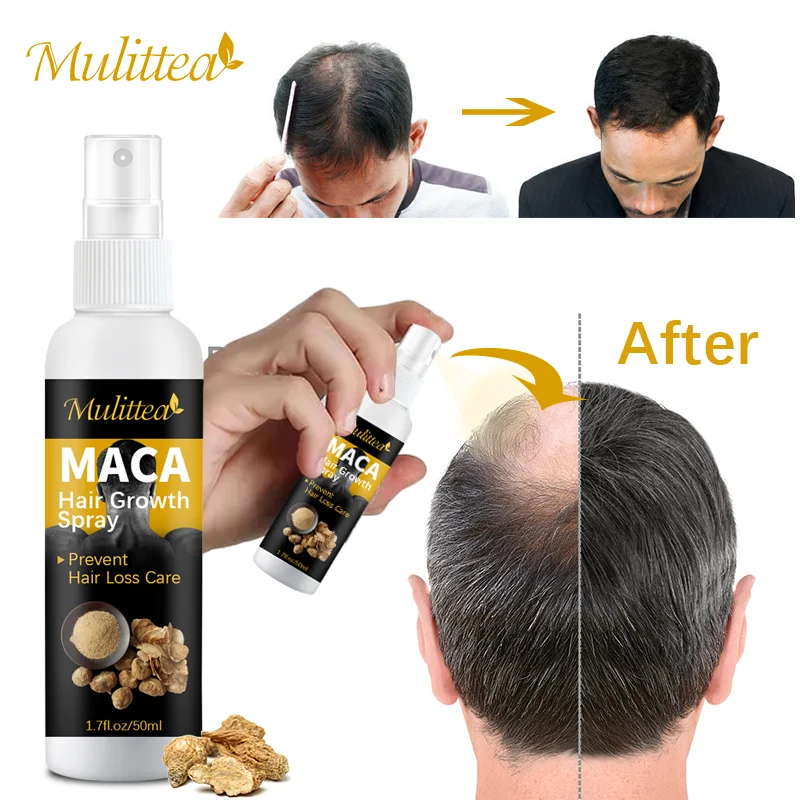 Mulittea Maca Extract Hair Growth Spray Serum Anti Hair Loss Products Fast Grow Prevent Dry Frizzy Damaged Thinning Repair Care
Mulittea Maca Extract Hair Growth Spray Serum Anti Hair Loss Products Fast Grow Prevent Dry Frizzy Damaged Thinning Repair Care