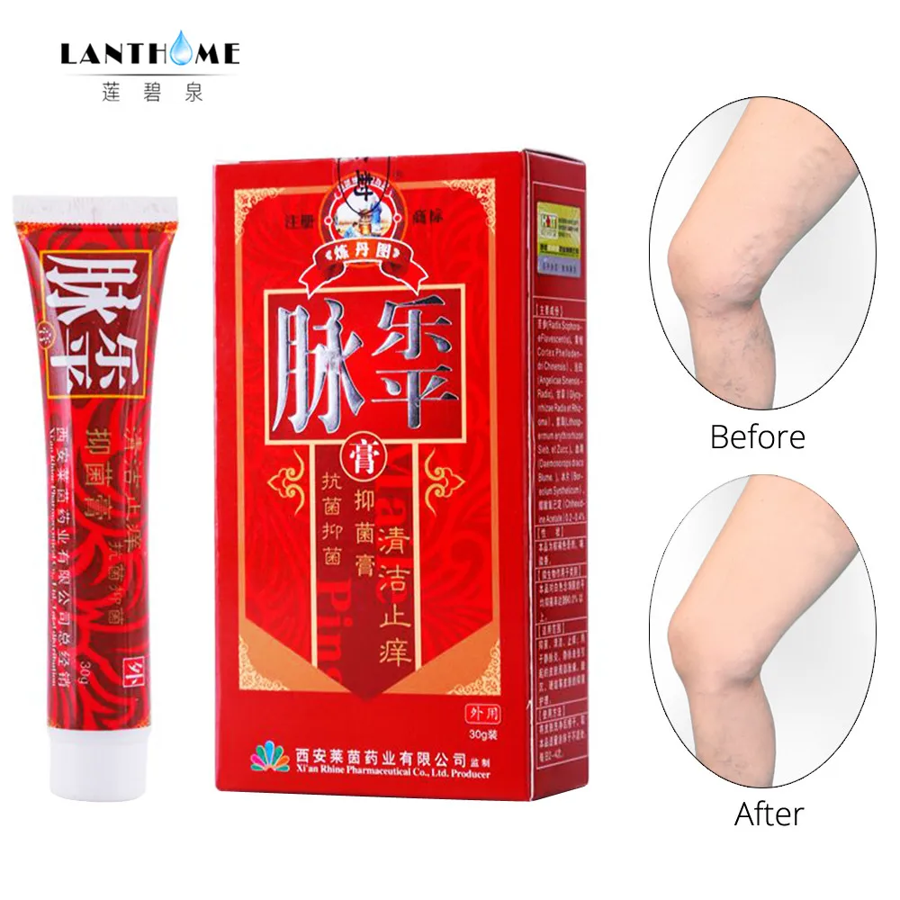 Varicose Veins Treatment Cream Ointment Vasculitis Phlebitis Spider Veins Pain Varicosity Angiitis Remedy Removal Herbal Cream
Varicose Veins Treatment Cream Ointment Vasculitis Phlebitis Spider Veins Pain Varicosity Angiitis Remedy Removal Herbal Cream
