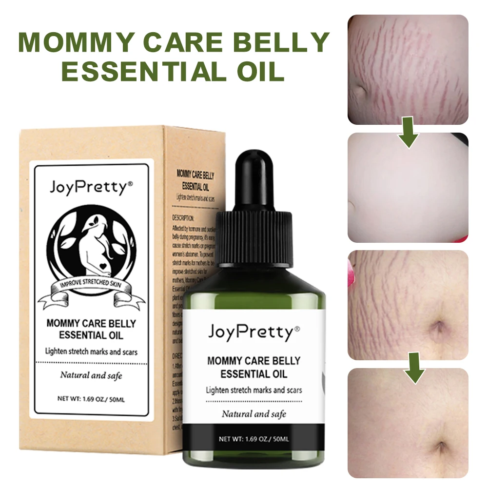 Stretch Marks Remover Essential Oil Safe Natural Lighten Stretch Mark Scars Safe For Pregnancy Improve Skin Elasticity For Women
Stretch Marks Remover Essential Oil Safe Natural Lighten Stretch Mark Scars Safe For Pregnancy Improve Skin Elasticity For Women
