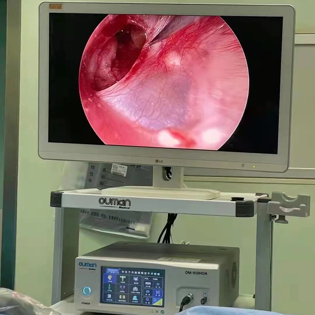 SDI camera content endoscope medical module AWB 60fps 1080p medical HD endoscope camera
SDI camera content endoscope medical module AWB 60fps 1080p medical HD endoscope camera