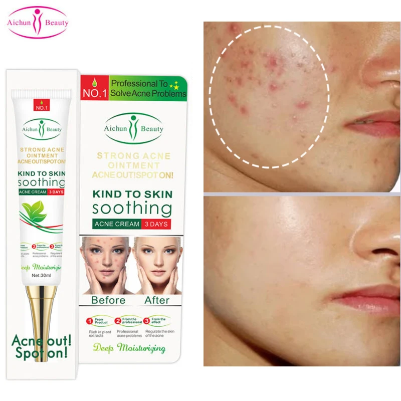 3 Days Acne Treatment Face Cream Acne Scar Removal Repair Gel Whitening Oil Control Moisturizing Shrink Pores Firming Skin Care
3 Days Acne Treatment Face Cream Acne Scar Removal Repair Gel Whitening Oil Control Moisturizing Shrink Pores Firming Skin Care