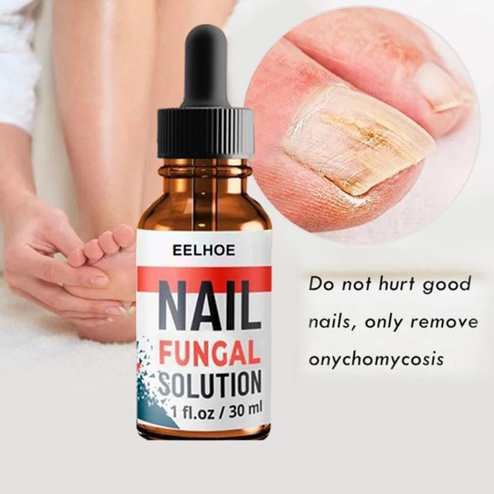 Nail Fungus Treatment for Fingernails and Toenails Repair Solution for Cracked Discolored Fungus Nails
Nail Fungus Treatment for Fingernails and Toenails Repair Solution for Cracked Discolored Fungus Nails