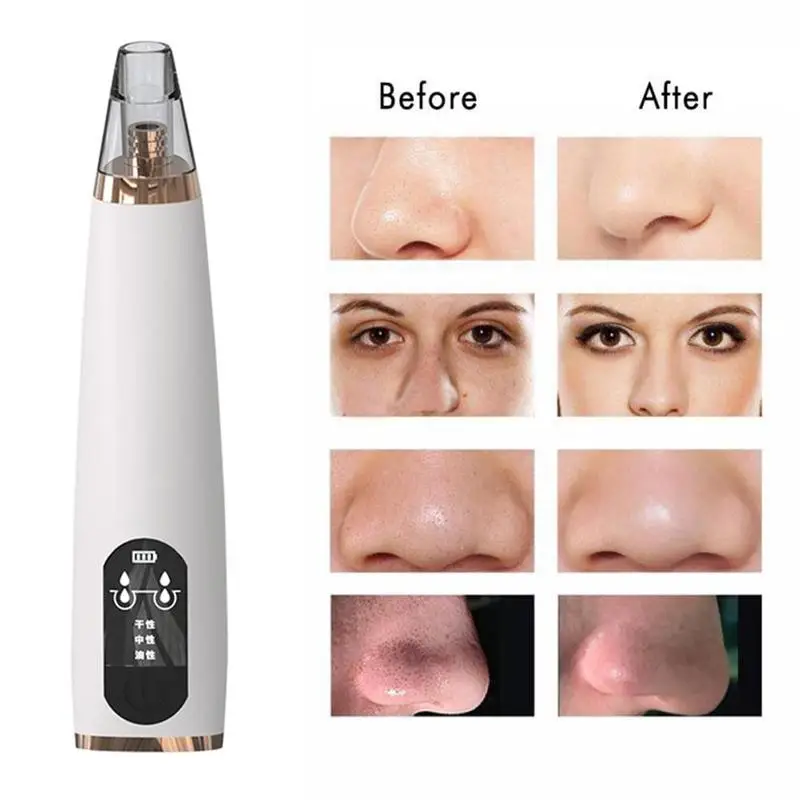 1pcs Electric Vacuum Blackhead Remover Machine Face Deep Nose Cleaner T Zone Pore Acne Pimple Removal Beauty Devices Tool
1pcs Electric Vacuum Blackhead Remover Machine Face Deep Nose Cleaner T Zone Pore Acne Pimple Removal Beauty Devices Tool