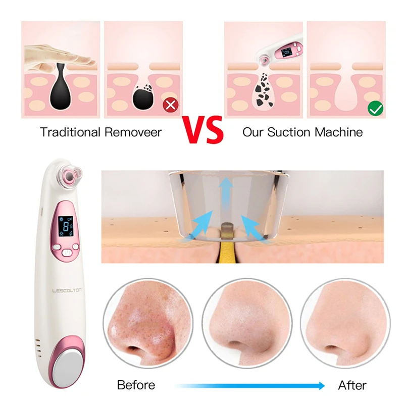 Ckeyin 2 In 1 Blackhead Remover Cold Hot Face Massager For Women Men Face Deep Cleaning Blackhead Acne Vacuum Suction Face Care
Ckeyin 2 In 1 Blackhead Remover Cold Hot Face Massager For Women Men Face Deep Cleaning Blackhead Acne Vacuum Suction Face Care