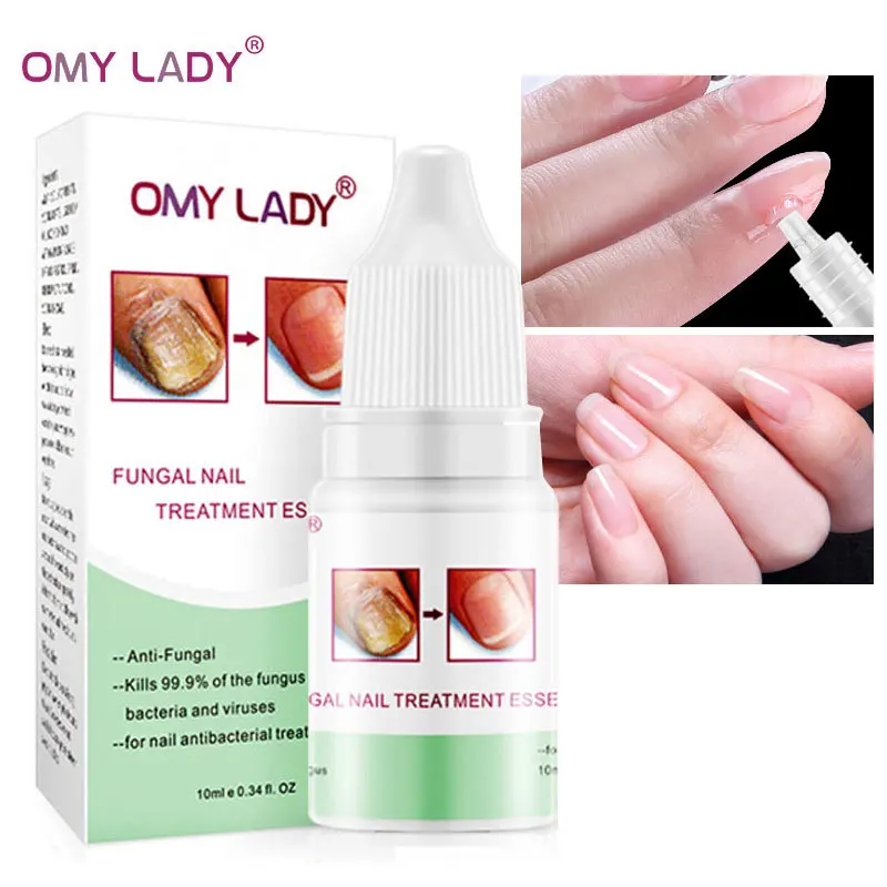 Fungus Nail Fungal Repair Essence Serum Toe Nail Fungus Treatment Gel Paronychia Onychomycosis Anti Infection Foot Hands Care
Fungus Nail Fungal Repair Essence Serum Toe Nail Fungus Treatment Gel Paronychia Onychomycosis Anti Infection Foot Hands Care