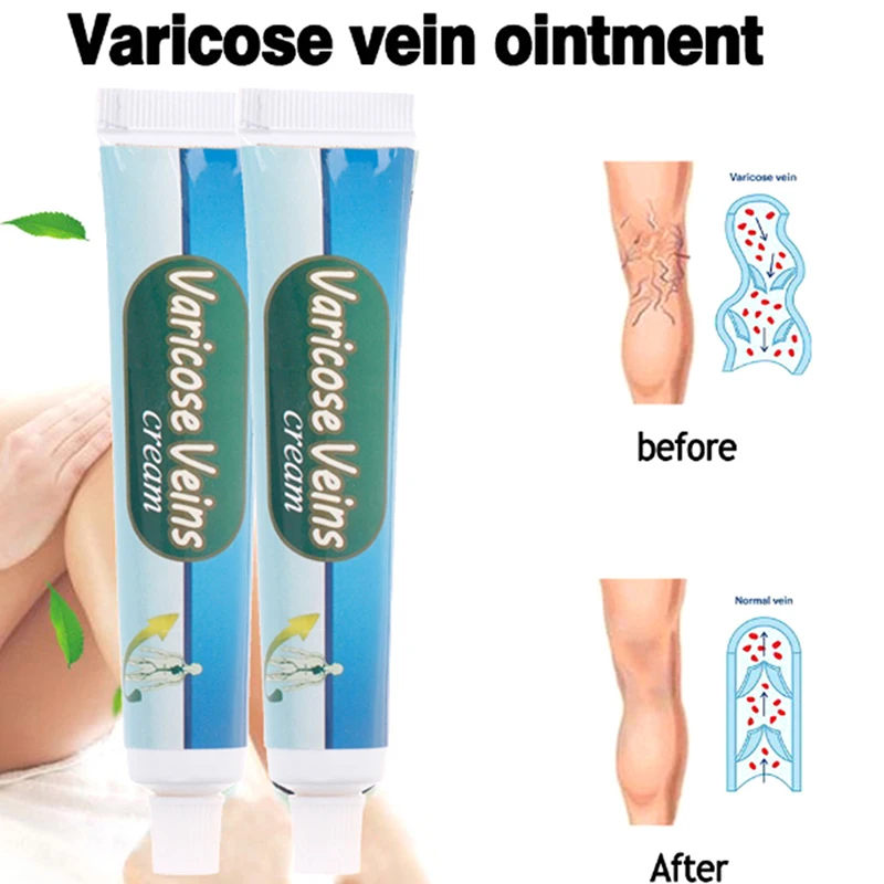 Natural Herbal Veins Cream Chinese Medicine For Varicose Veins Ointment Vasculitis Inflammation Leg Massage Varicose Veins Cream
Natural Herbal Veins Cream Chinese Medicine For Varicose Veins Ointment Vasculitis Inflammation Leg Massage Varicose Veins Cream