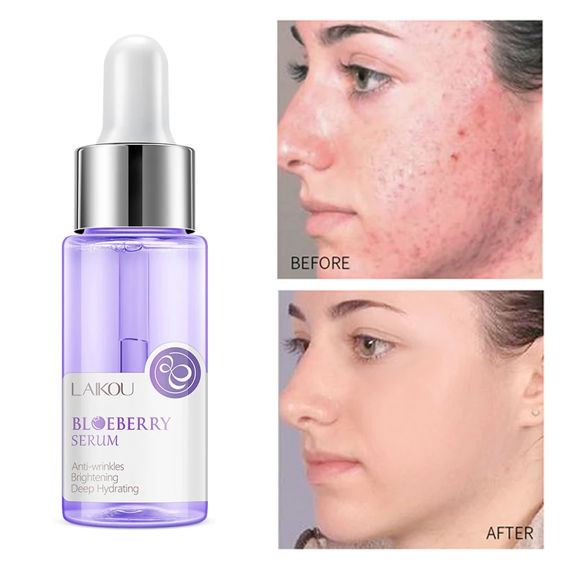 LAIKOU Blueberry Anti Wrinkles Facial Serum Brighten Skin Tone Hydrating Repair Damaged Skin Whitening Remove Spots Skin Care
LAIKOU Blueberry Anti Wrinkles Facial Serum Brighten Skin Tone Hydrating Repair Damaged Skin Whitening Remove Spots Skin Care
