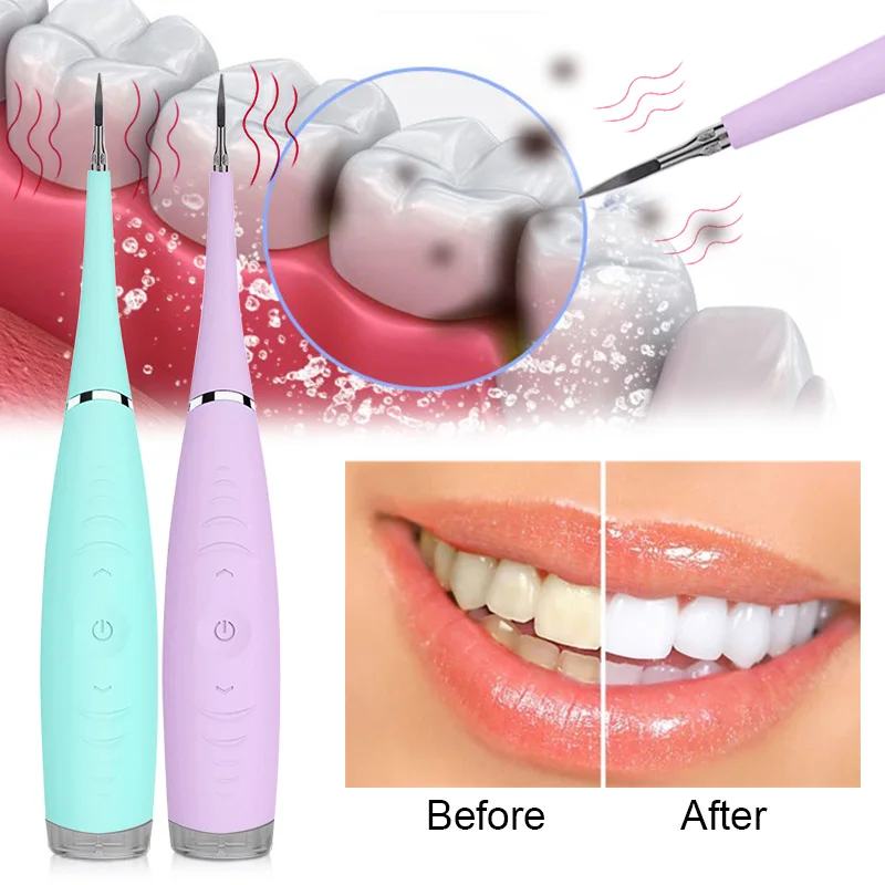 Electric Ultrasonic Sonic Dental Scaler Tooth Calculus Remover Cleaner Tooth Stains Tartar Tool Whiten Teeth Tartar Remove Tools
Electric Ultrasonic Sonic Dental Scaler Tooth Calculus Remover Cleaner Tooth Stains Tartar Tool Whiten Teeth Tartar Remove Tools