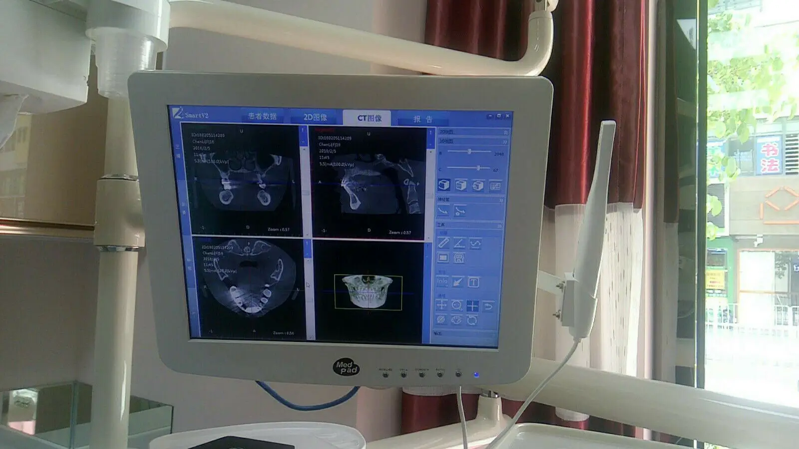 High Quality Dental Touch screen capacitive monitor with intraoral camera built in Intel/Windows10
High Quality Dental Touch screen capacitive monitor with intraoral camera built in Intel/Windows10
