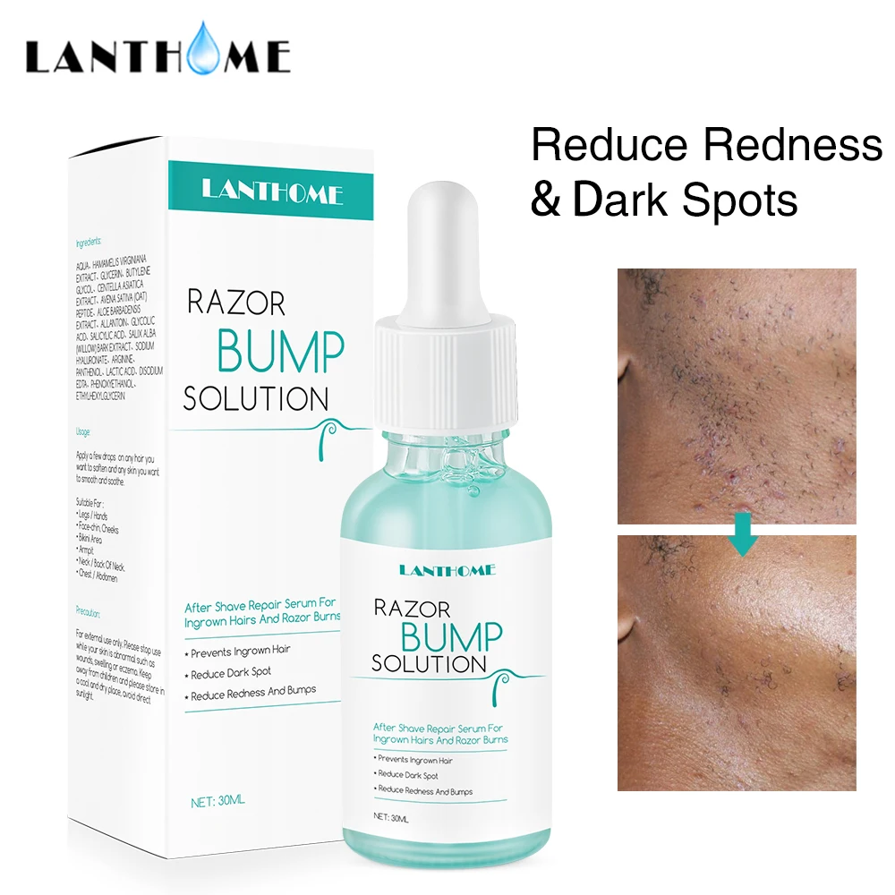 30ml Razor Bump Stopper Ingrown After Shave Reduce Dark Spots Redness Razor Burns Solution for Men Women Hair Treatment
30ml Razor Bump Stopper Ingrown After Shave Reduce Dark Spots Redness Razor Burns Solution for Men Women Hair Treatment