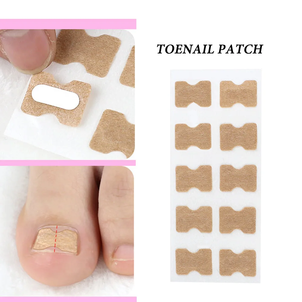 Ingrown Toenail Corrector Sticker Paronychia Treatment Fixer Recover Corrector Pedicure Foot Toe Nail Care Tool
Ingrown Toenail Corrector Sticker Paronychia Treatment Fixer Recover Corrector Pedicure Foot Toe Nail Care Tool