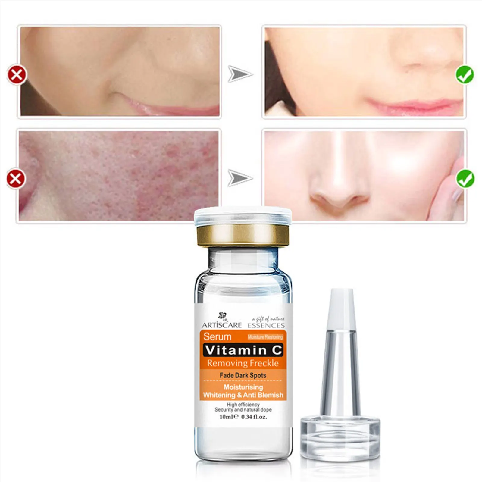 ARTISCARE Vitamin C Serum For Face Care Anti Acne Scar Removal Spots Freckle VC Essence Hyaluronic Acid Whitening Facial Cream
ARTISCARE Vitamin C Serum For Face Care Anti Acne Scar Removal Spots Freckle VC Essence Hyaluronic Acid Whitening Facial Cream