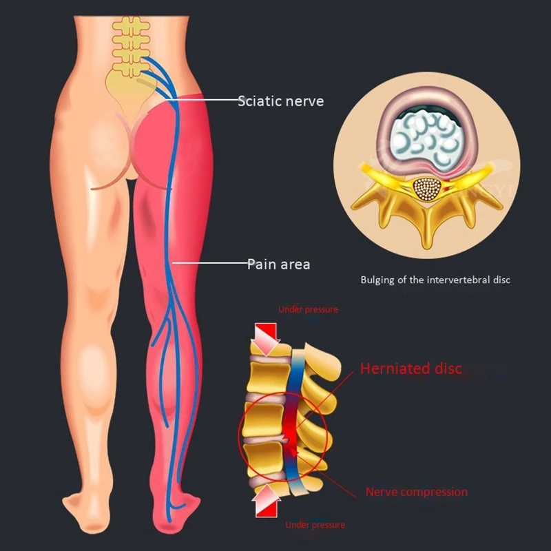 Back Stretcher Lumbar Pain Acupuncture Back Massager Posture Relief Spine Corrector Tensioner Orthosis
Back Stretcher Lumbar Pain Acupuncture Back Massager Posture Relief Spine Corrector Tensioner Orthosis