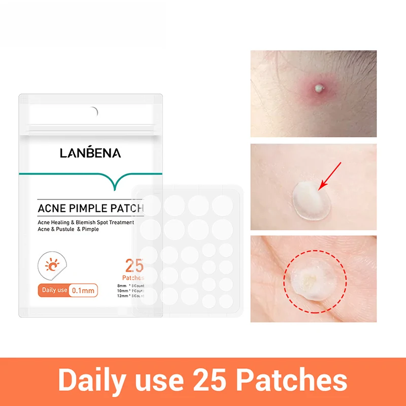 Tea Tree Acne Pimple Patch Transparent Invisible Stickers Repair Pustules Acne Blemish Treatment Soothe Skin Beauty Care Tool
Tea Tree Acne Pimple Patch Transparent Invisible Stickers Repair Pustules Acne Blemish Treatment Soothe Skin Beauty Care Tool