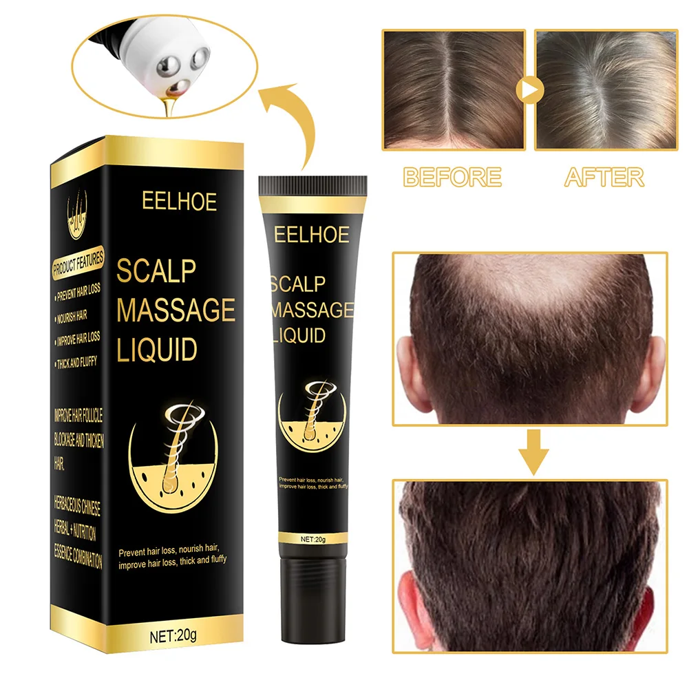 New Hair Scalp Massage Oil 20 Ml Roll On Massager For Hair Loss Damaged Hair Soft And Glossy Growth Essential Oil For Men Women
New Hair Scalp Massage Oil 20 Ml Roll On Massager For Hair Loss Damaged Hair Soft And Glossy Growth Essential Oil For Men Women