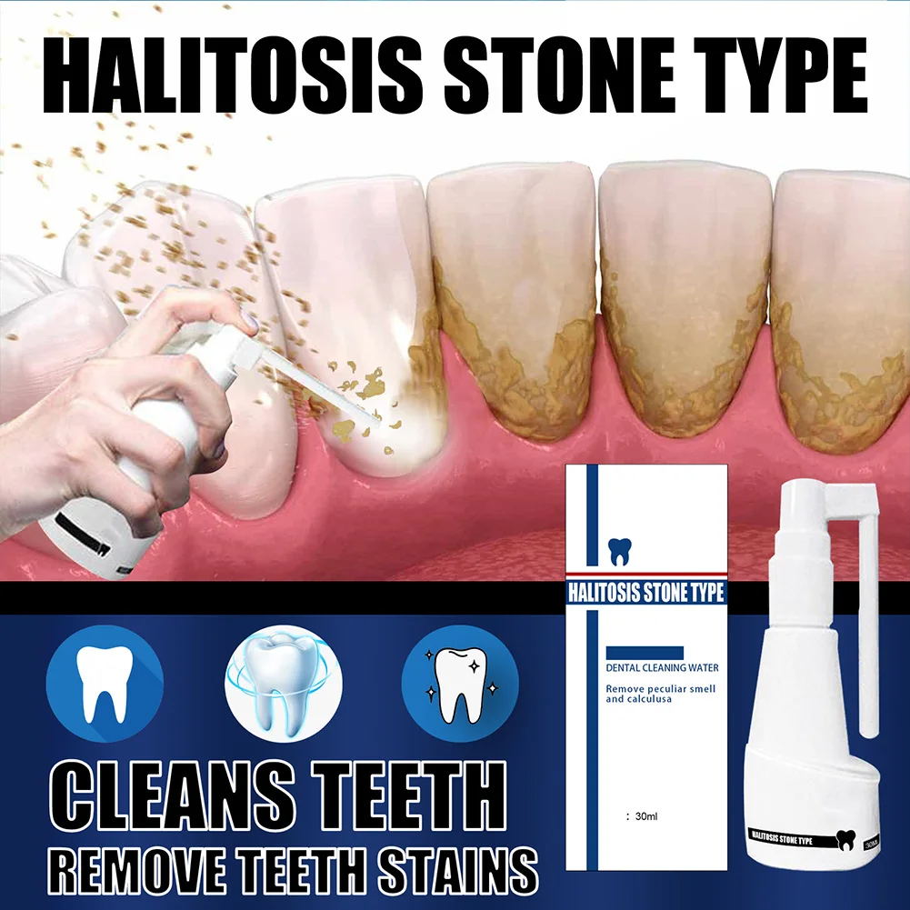 Dental Calculus Cleaning Halitosis Stone Type Remove Teeth Whitening Dental Cleaning Water Remove Peculiar Smell and Calculus
Dental Calculus Cleaning Halitosis Stone Type Remove Teeth Whitening Dental Cleaning Water Remove Peculiar Smell and Calculus