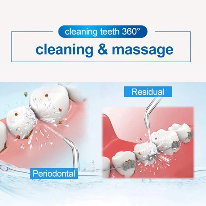 Replacement Classic Jet Tips Dental Water Jet Nozzle Accessories for Waterpik Water Flossers and Other Oral Irrigators U1JE
Replacement Classic Jet Tips Dental Water Jet Nozzle Accessories for Waterpik Water Flossers and Other Oral Irrigators U1JE