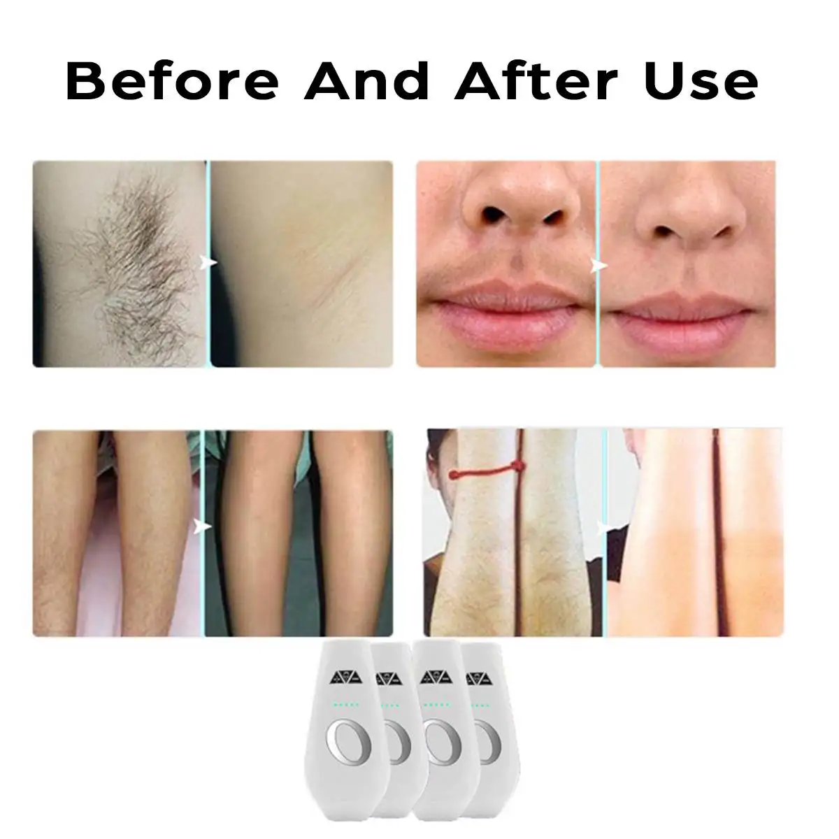990000 Flash Laser Hair Removal Machine Permanent Ipl Epilator Women Men Face Body Home Painless Hair Remover
990000 Flash Laser Hair Removal Machine Permanent Ipl Epilator Women Men Face Body Home Painless Hair Remover