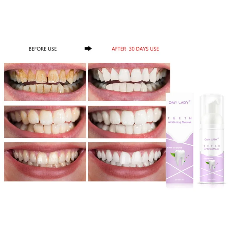 Teeth Cleaning Mousse Remove Tooth Stains Freshen Breath Teeth Whitening Foam Toothpaste P6 
Teeth Cleaning Mousse Remove Tooth Stains Freshen Breath Teeth Whitening Foam Toothpaste P6